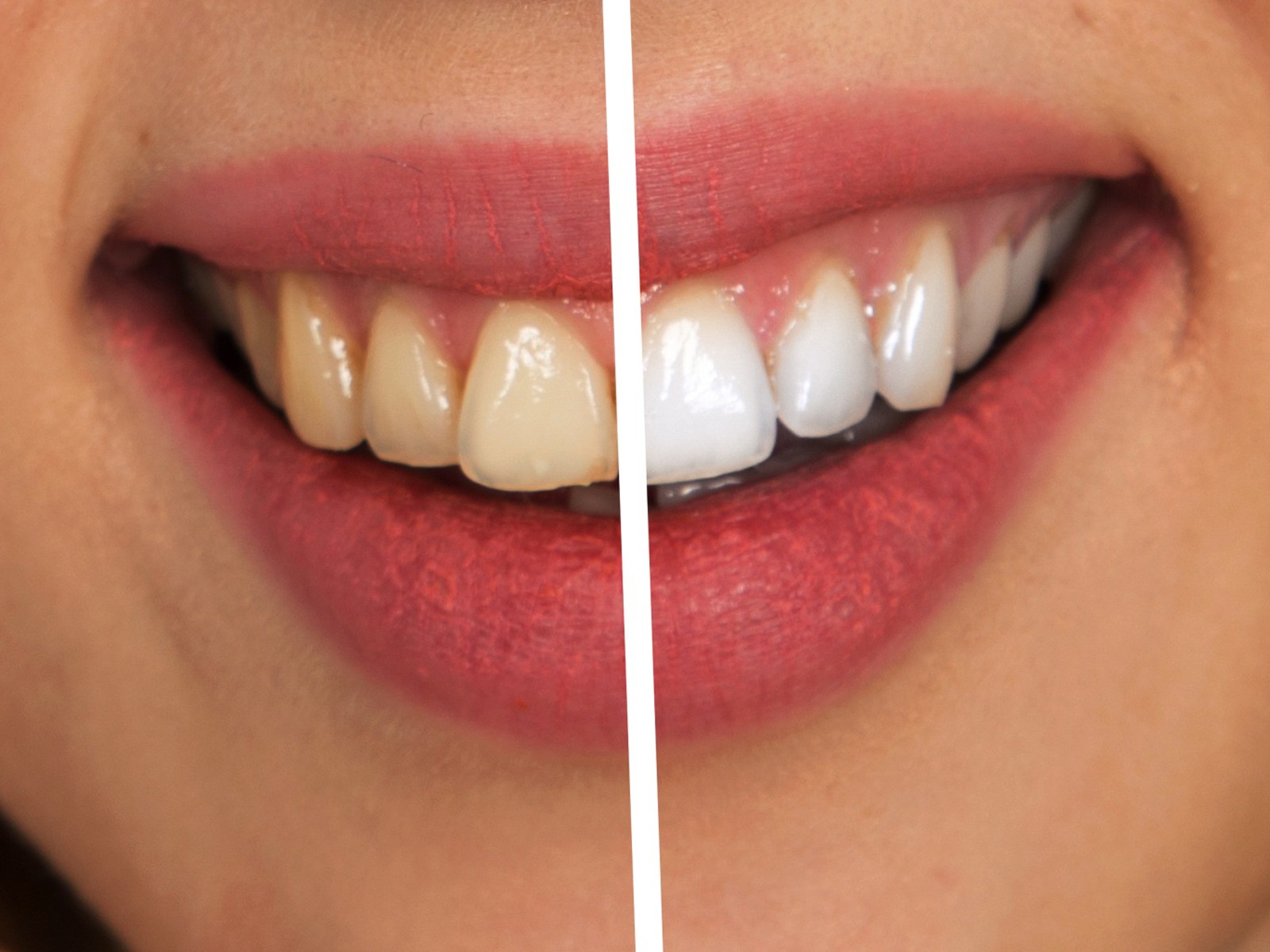 How can I make my yellow teeth whiter naturally?