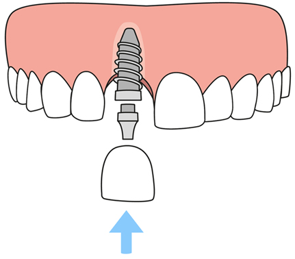 Dentist in 77372 TX