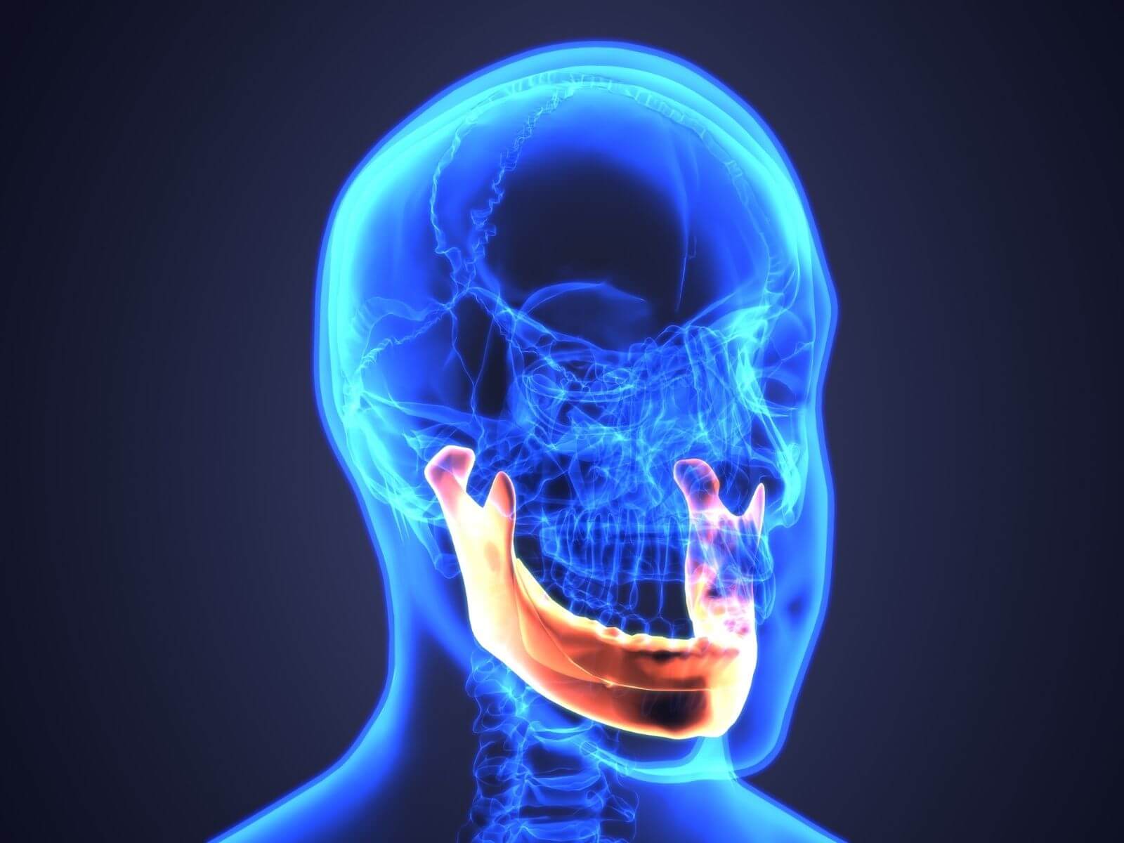 TMJ Disorder Symptoms: 10 Signs of Jaw Joint Problems