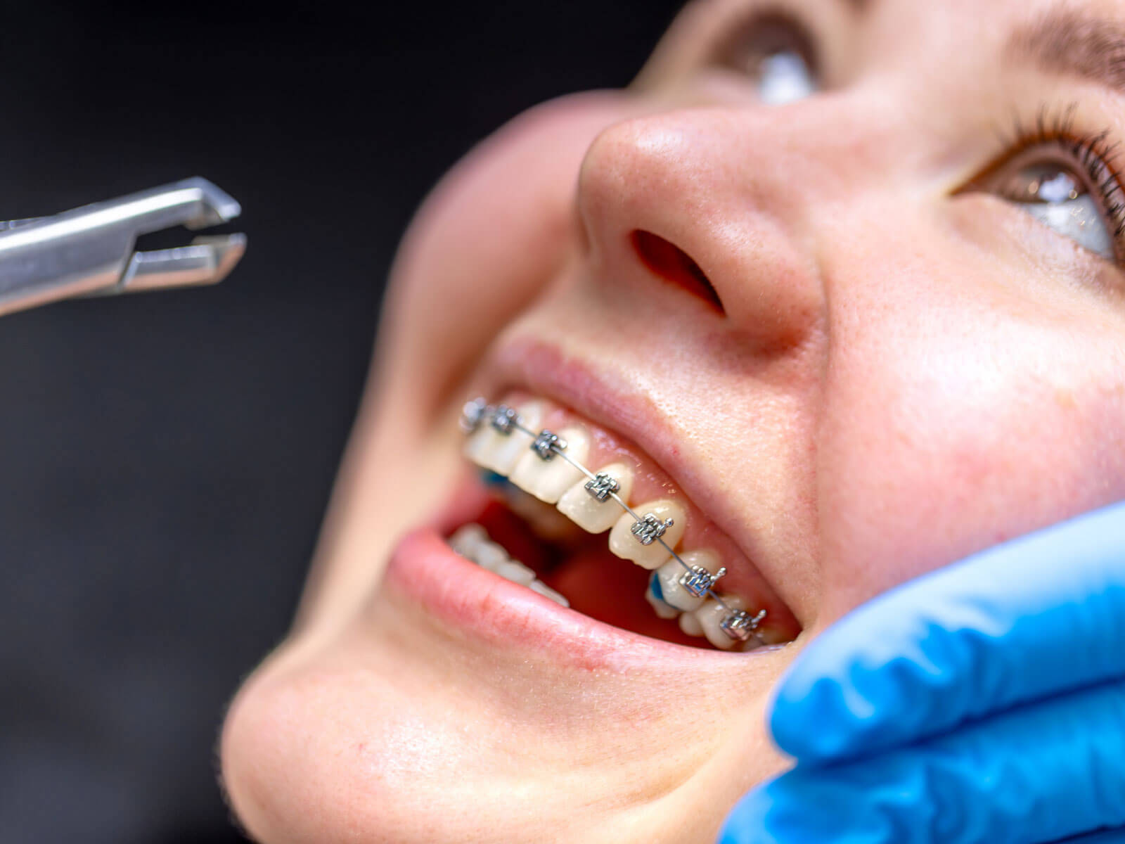 How to Choose an Orthodontist Without Just Picking the One With the Nicest Waiting Room